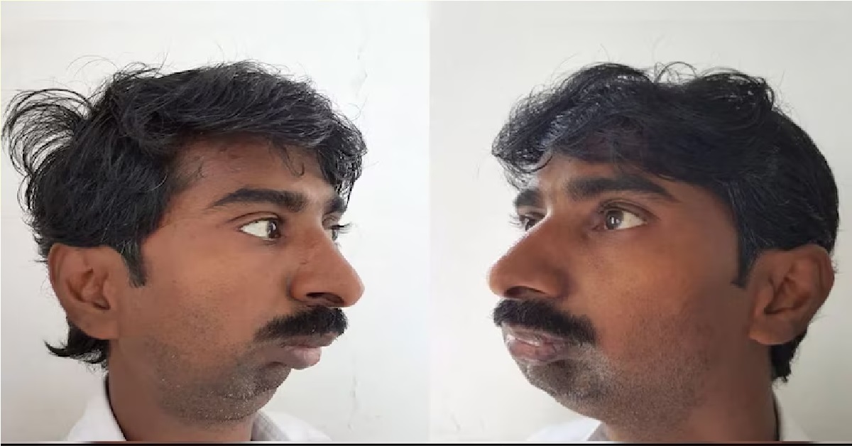 Who Is Rajendra Panchal? Pune Man Whose Viral Pic Is Used In Racist Posts Against Indians